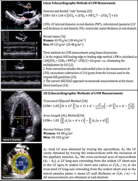 lv spelden|Echocardiographic Assessment of Left Ventricular .